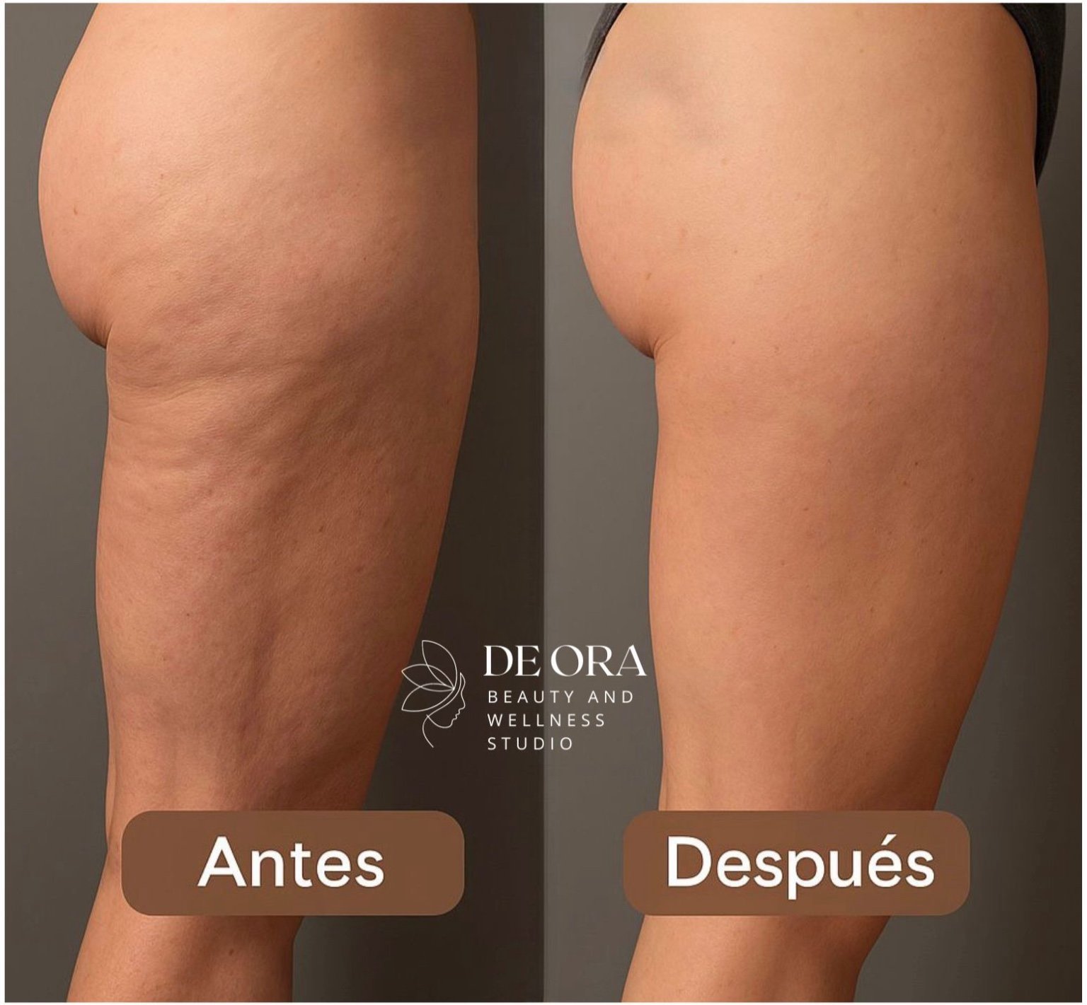 Antes/Después 1