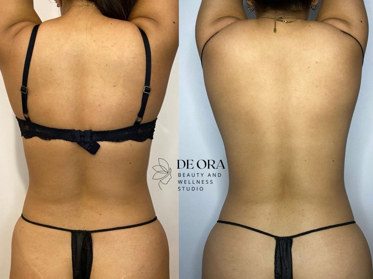Antes/Después 2